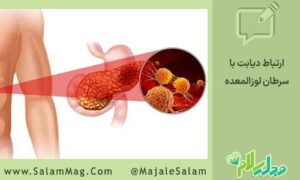link-between-diabetes-and-pancreatic-cancer