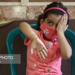 تنبلی چشم دومین علت کاهش بینایی کودکان بررسی سلامت چشم سالمندان در طرح سلام