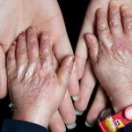 ۹۵ درصد بیماران «ای بی» حاصل ازدواج فامیلی