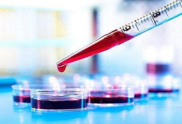 آزمایش خون می‌تواند بیماری کرون را پیش‌بینی کند