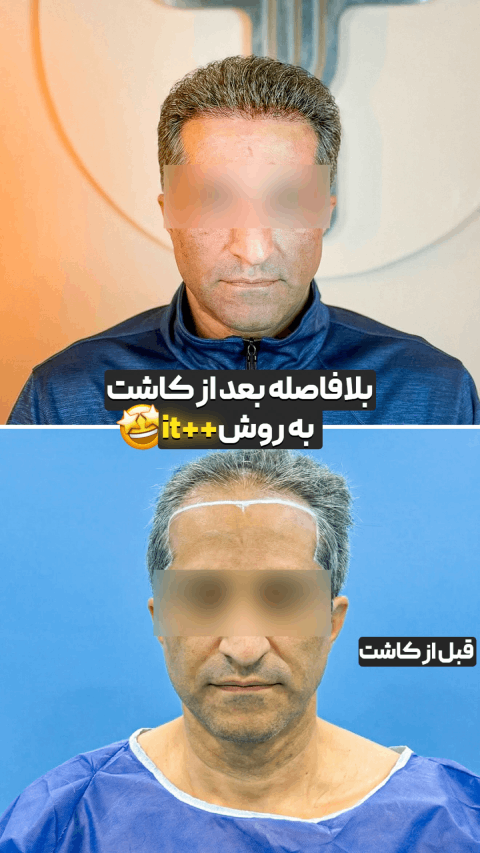 کلینیک تهران کاشت