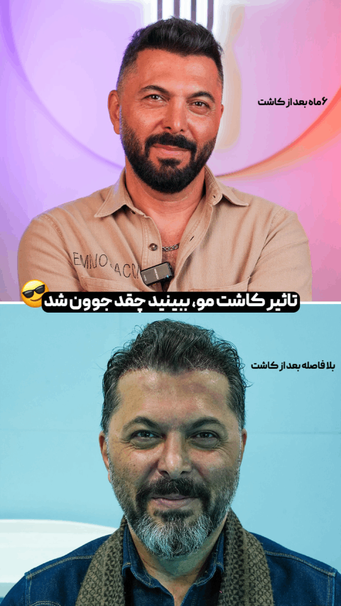 کلینیک تهران کاشت2