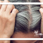 موهای سفید به رنگ طبیعی برمی‌گردند؟