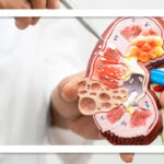 کم‌آبی به‌تنهایی باعث ایجاد سنگ نمی‌شود