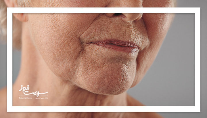 چگونه با افزایش سن از «پروتئین نگهدارنده بدن» مراقبت کنیم؟