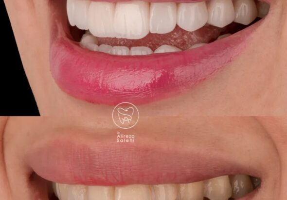 راز پنهان لبخندهای ماندگار؛ چرا دندانپزشکی مدرن مسیر پیشگیری و زیبایی را یکی کرد؟