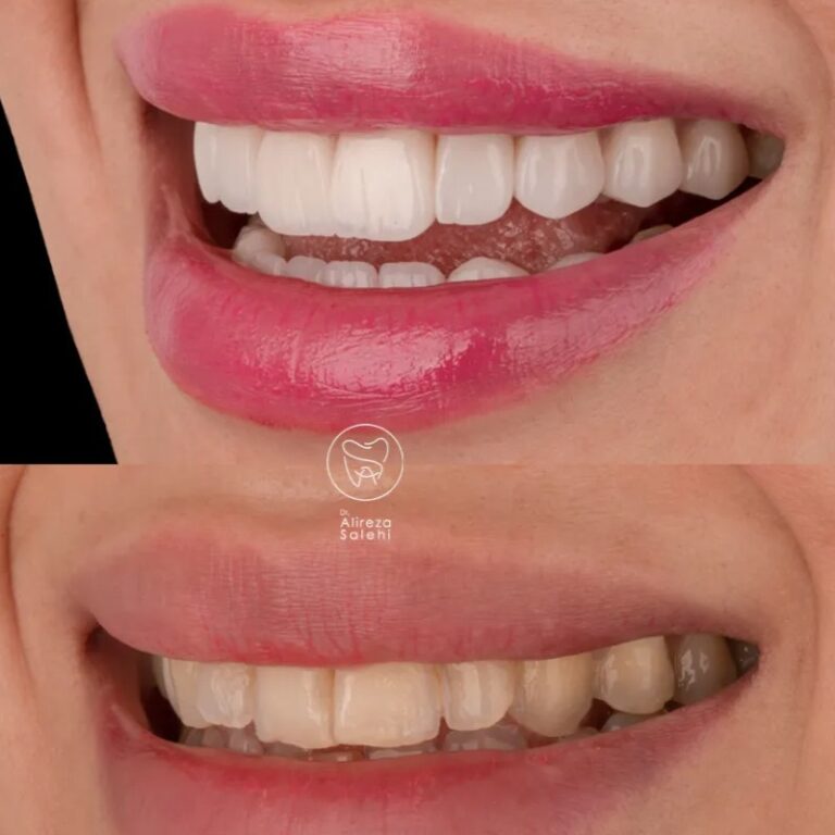 راز پنهان لبخندهای ماندگار؛ چرا دندانپزشکی مدرن مسیر پیشگیری و زیبایی را یکی کرد؟
