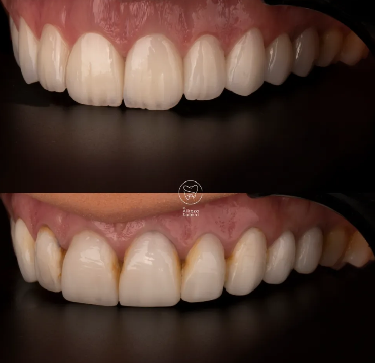 راز پنهان لبخندهای ماندگار؛ چرا دندانپزشکی مدرن مسیر پیشگیری و زیبایی را یکی کرد؟ تصویر 2